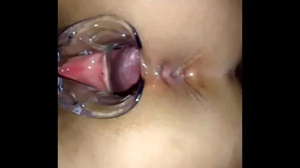 Hotte Inside the pussy with vaginal speculum varme filmer