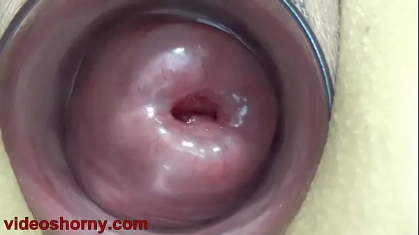 Nóng Uterus Penetration with Objects, Pumping Cervix Prolapse Phim ấm áp