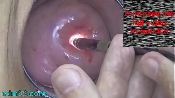Hot Endoscope Camera inside Cervix Cam into Pussy Uterus warm Movies