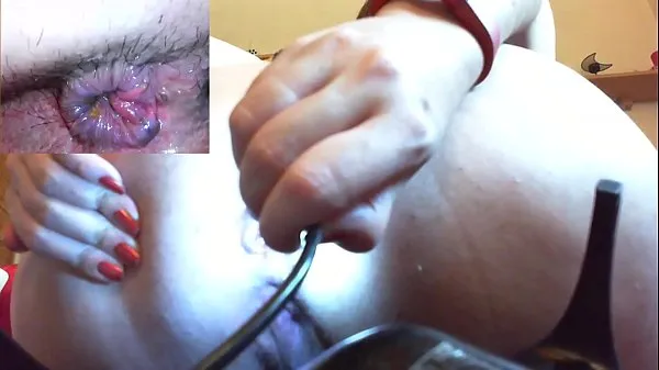 Medical anal endoscope fisting and extreme masturbation Film hangat yang hangat