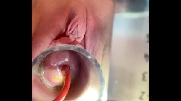 Hot Cries from as catheter balloon expands warm Movies