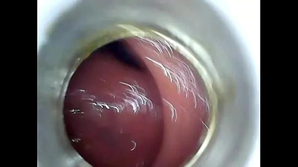 Hot Homemade anal insertion endoscope warm Movies
