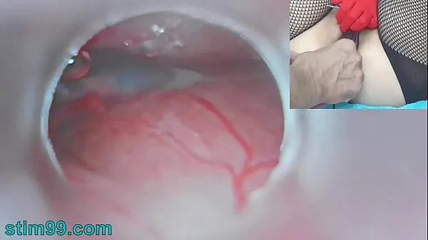 뜨거운 Uncensored Japanese Insemination with Cum into Uterus and Endoscope Camera by Cervix to watch inside womb 따뜻한 영화