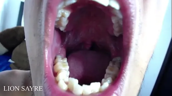 热Opening the mouth very wide until the uvula温暖的电影