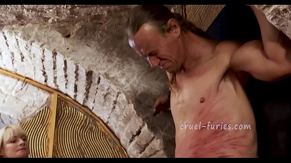 Hotte Painful Red Bruises on Poor Guy's Flesh varme filmer